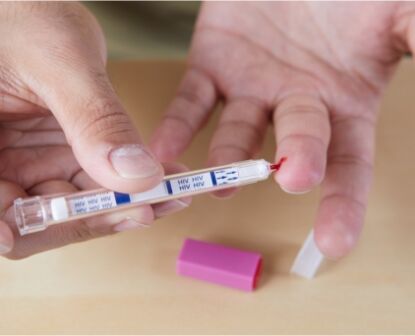 HIV TEST KIT