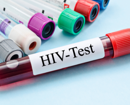 HIV Testing