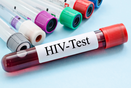 HIV Testing